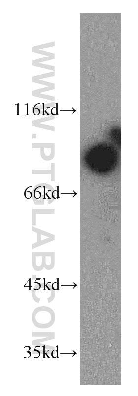 Western Blot (WB) analysis of HeLa cells using MARK1 Polyclonal antibody (21552-1-AP)
