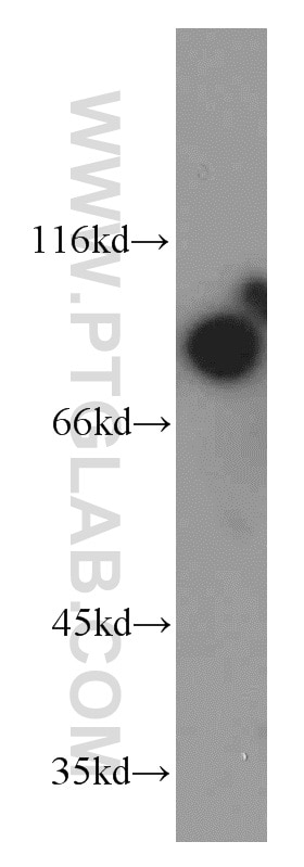 WB analysis of HeLa using 21552-1-AP