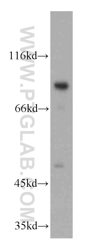 Western Blot (WB) analysis of SH-SY5Y cells using MARK1 Polyclonal antibody (21552-1-AP)