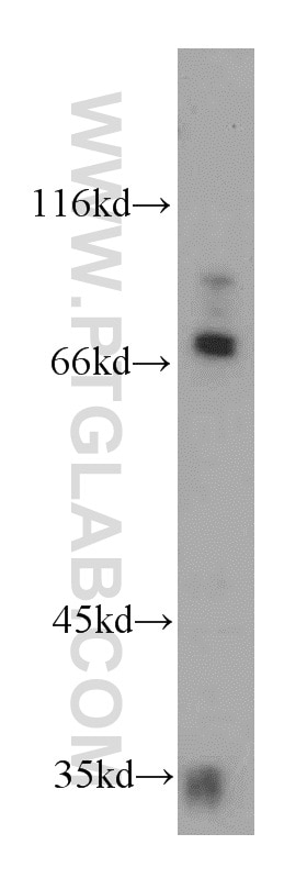 Western Blot (WB) analysis of mouse kidney tissue using MARK1 Polyclonal antibody (21552-1-AP)