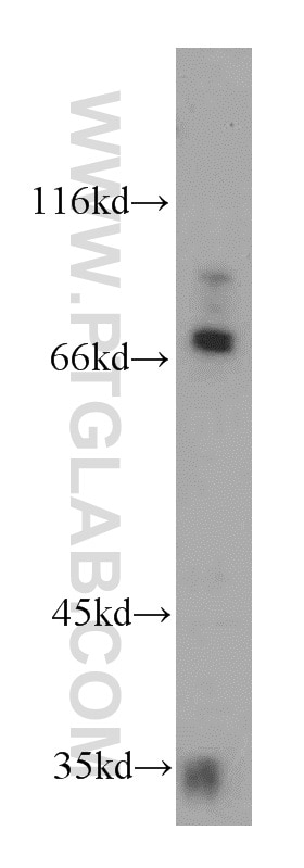 WB analysis of mouse kidney using 21552-1-AP