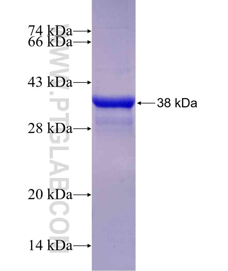 MARK1 fusion protein Ag16225 SDS-PAGE