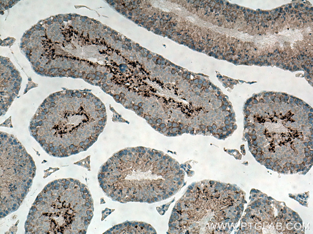 Immunohistochemistry (IHC) staining of mouse testis tissue using MARK2 Polyclonal antibody (15492-1-AP)