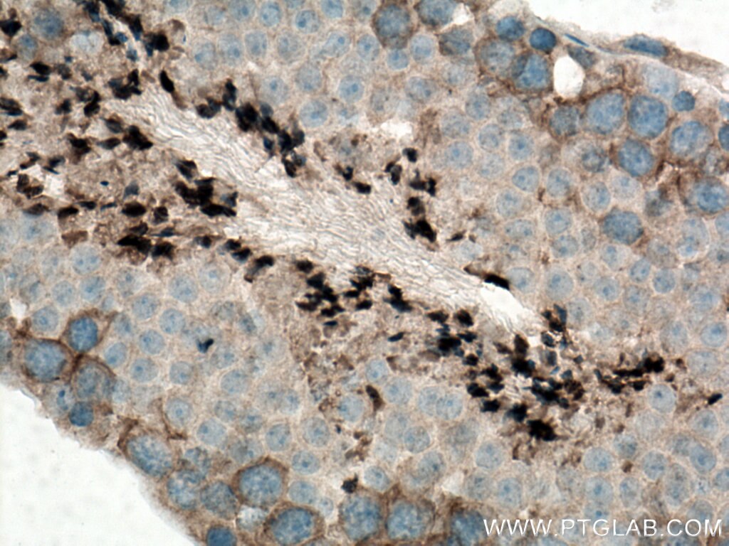 Immunohistochemistry (IHC) staining of mouse testis tissue using MARK2 Polyclonal antibody (15492-1-AP)