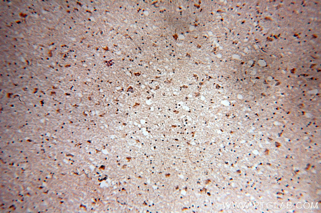Immunohistochemistry (IHC) staining of human brain tissue using MARK2 Polyclonal antibody (15492-1-AP)