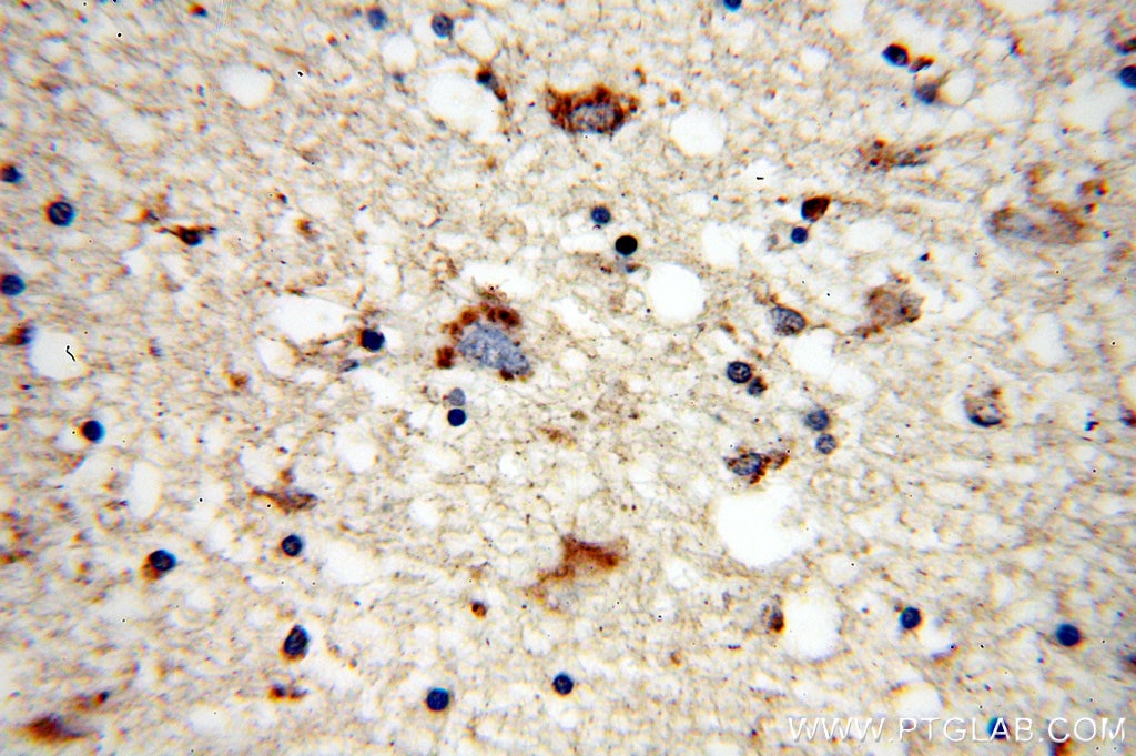 Immunohistochemistry (IHC) staining of human brain tissue using MARK2 Polyclonal antibody (15492-1-AP)
