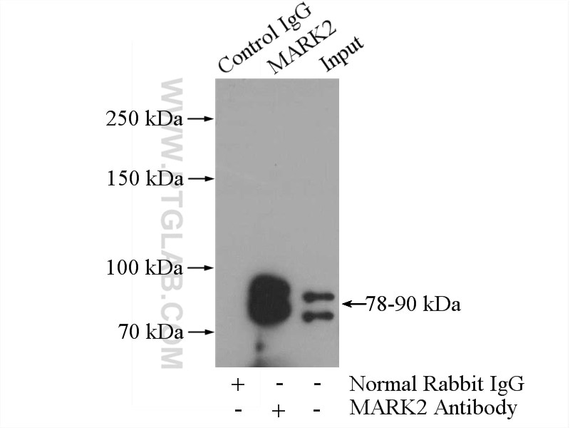 Immunoprecipitation (IP) experiment of rat brain tissue using MARK2 Polyclonal antibody (15492-1-AP)