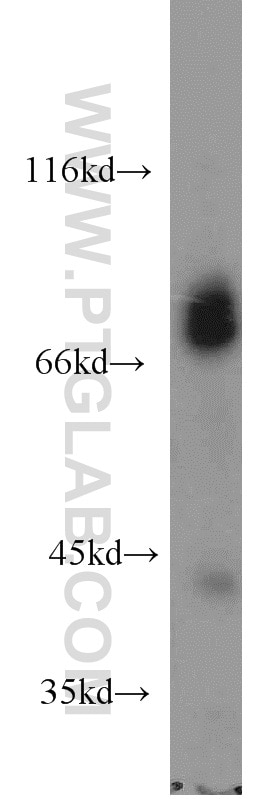 Western Blot (WB) analysis of mouse brain tissue using MARK2 Polyclonal antibody (15492-1-AP)