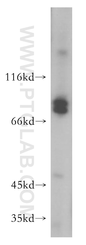 Western Blot (WB) analysis of mouse brain tissue using MARK2 Polyclonal antibody (15492-1-AP)