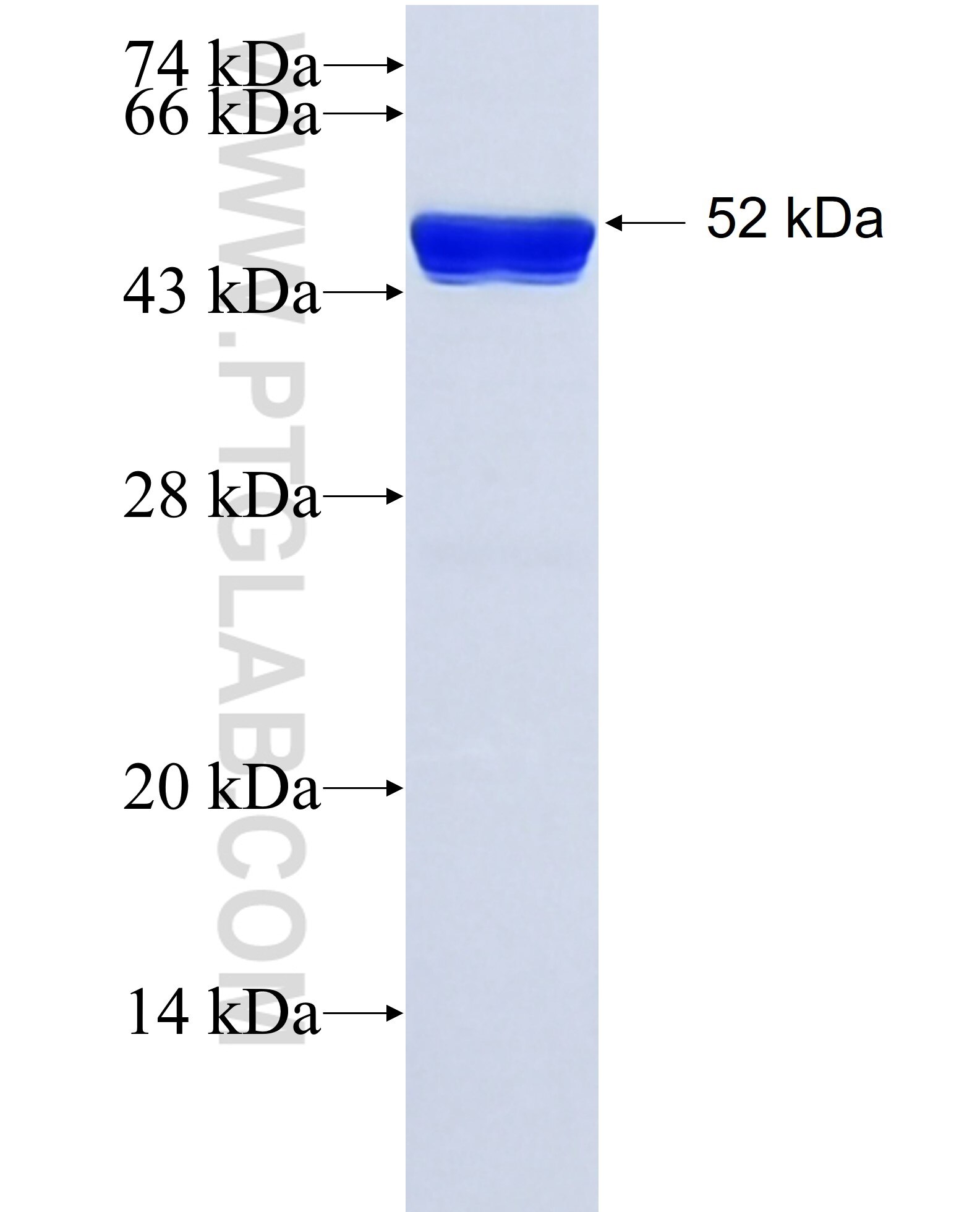 MARK2 fusion protein Ag7884 SDS-PAGE