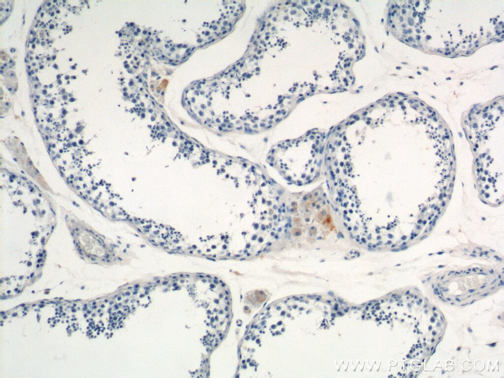 Immunohistochemistry (IHC) staining of human testis tissue using MARK4 Polyclonal antibody (20174-1-AP)