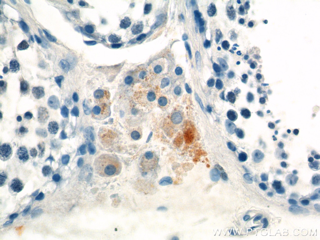 Immunohistochemistry (IHC) staining of human testis tissue using MARK4 Polyclonal antibody (20174-1-AP)