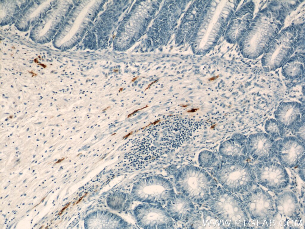 Immunohistochemistry (IHC) staining of human colon tissue using MARK4 Polyclonal antibody (20174-1-AP)