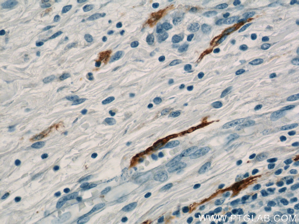 Immunohistochemistry (IHC) staining of human colon tissue using MARK4 Polyclonal antibody (20174-1-AP)