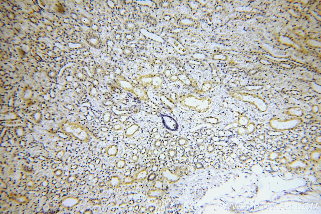 Immunohistochemistry (IHC) staining of human kidney tissue using MARK4 Polyclonal antibody (20174-1-AP)