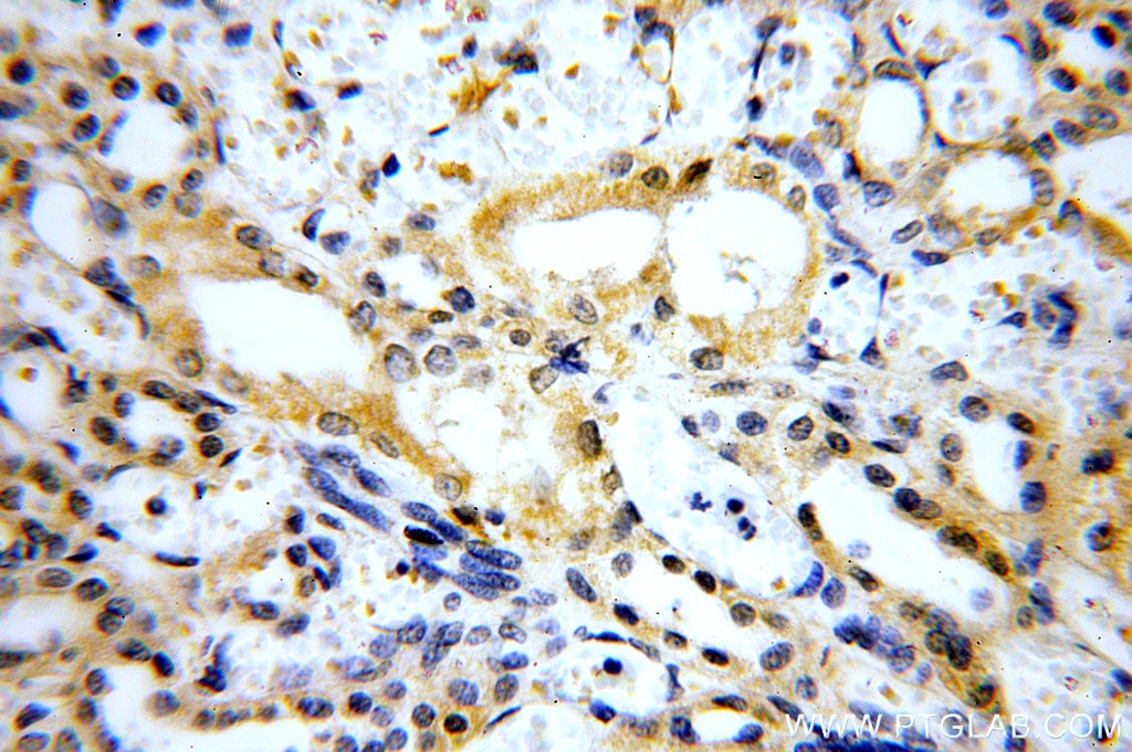 Immunohistochemistry (IHC) staining of human kidney tissue using MARK4 Polyclonal antibody (20174-1-AP)