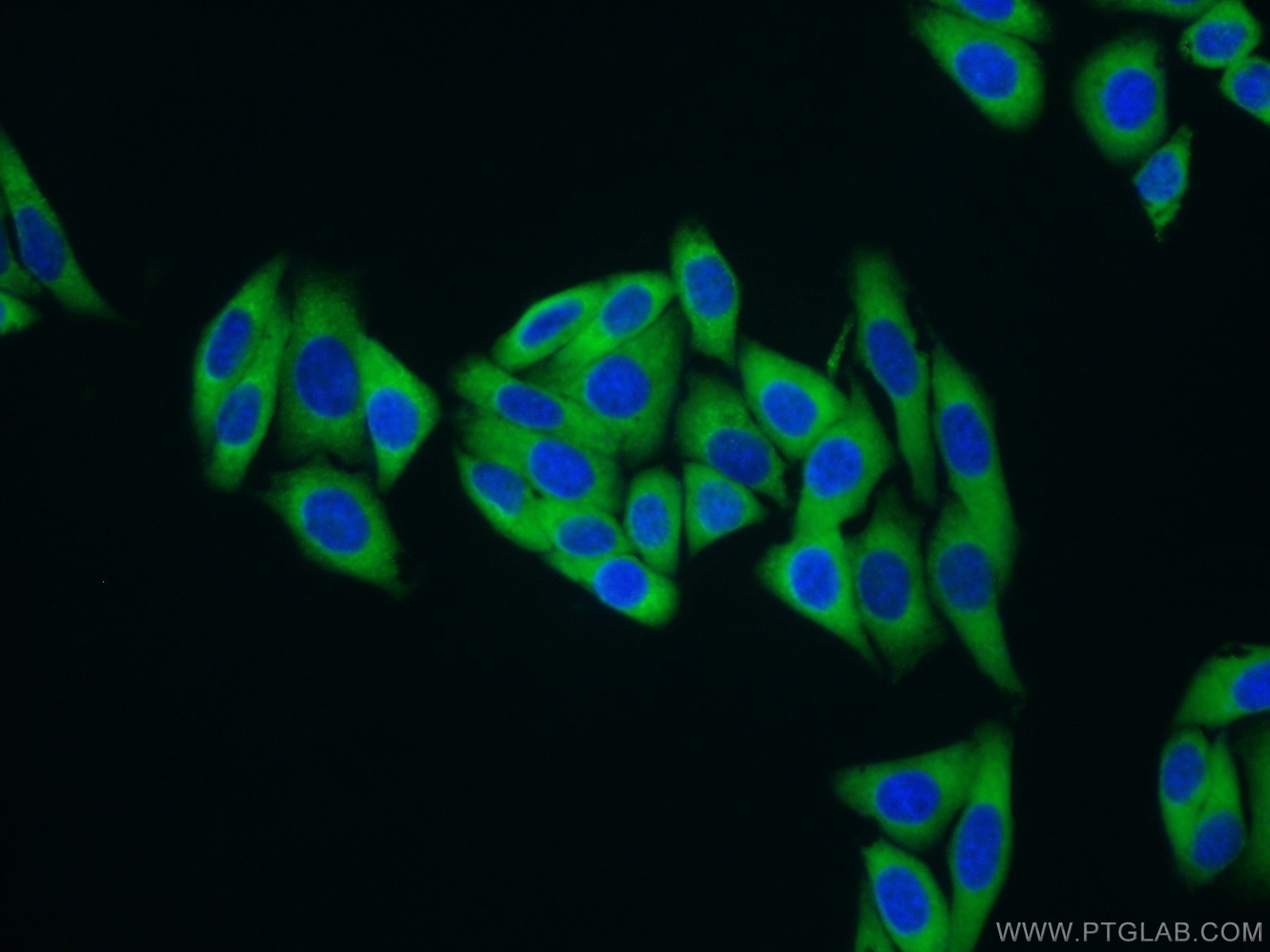 Immunofluorescence (IF) / fluorescent staining of HepG2 cells using MARS Polyclonal antibody (14829-1-AP)