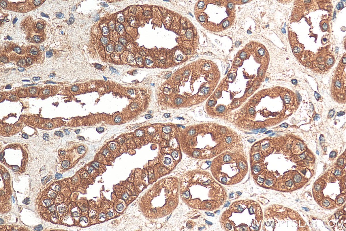 IHC staining of human kidney using 14829-1-AP