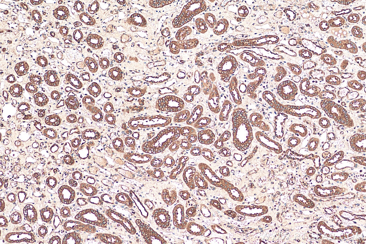 Immunohistochemistry (IHC) staining of human kidney tissue using MARS Polyclonal antibody (14829-1-AP)