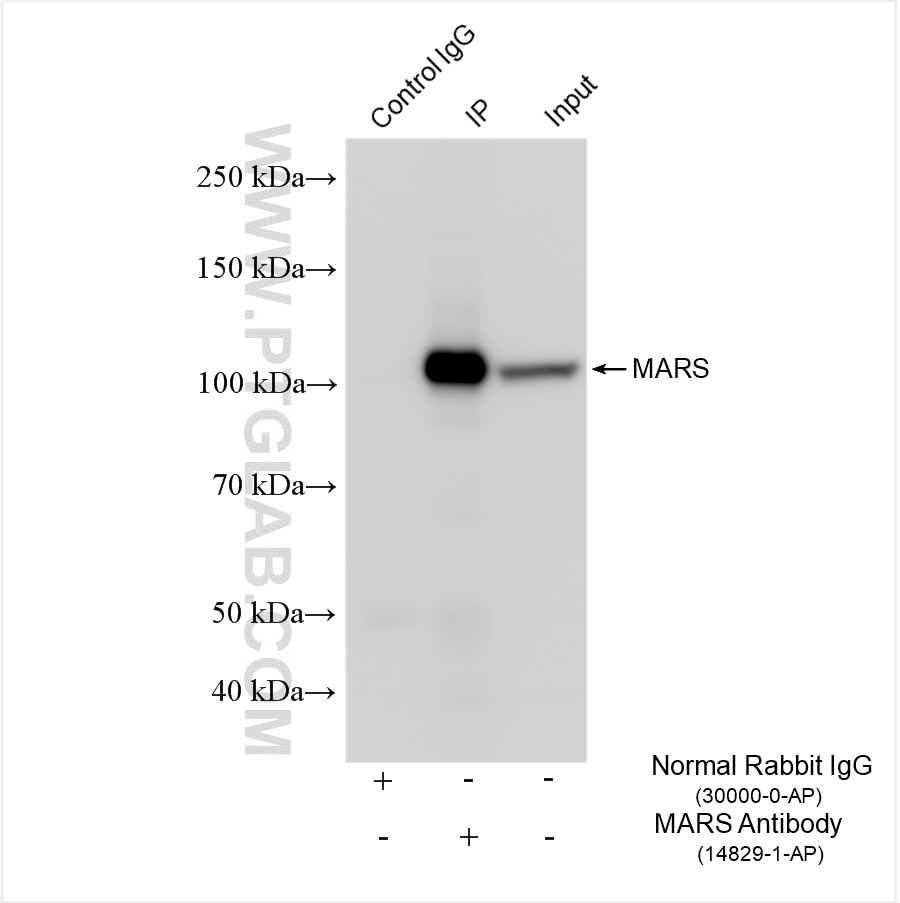 Immunoprecipitation (IP) experiment of HeLa cells using MARS Polyclonal antibody (14829-1-AP)