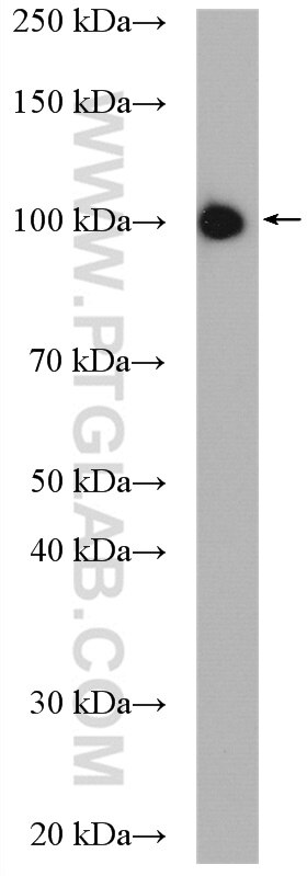 Western Blot (WB) analysis of HeLa cells using MARS Polyclonal antibody (14829-1-AP)