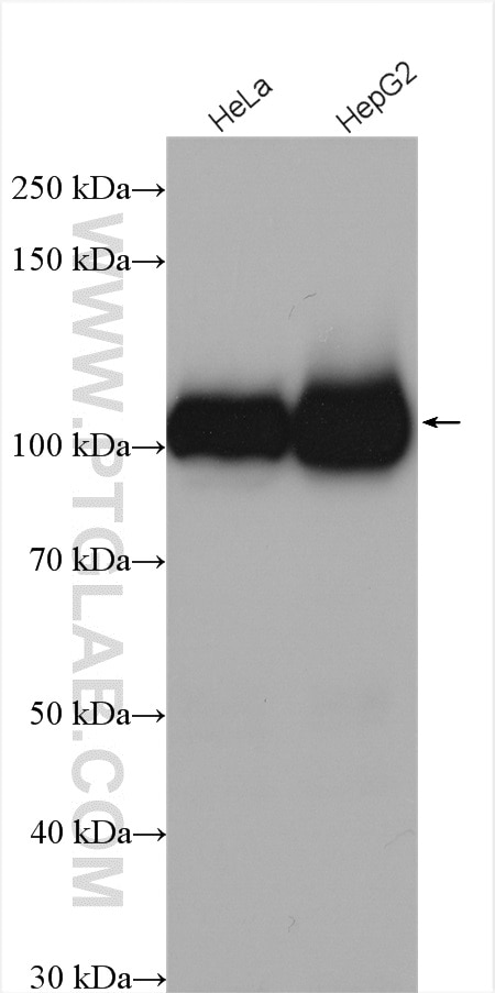 Western Blot (WB) analysis of various lysates using MARS Polyclonal antibody (14829-1-AP)