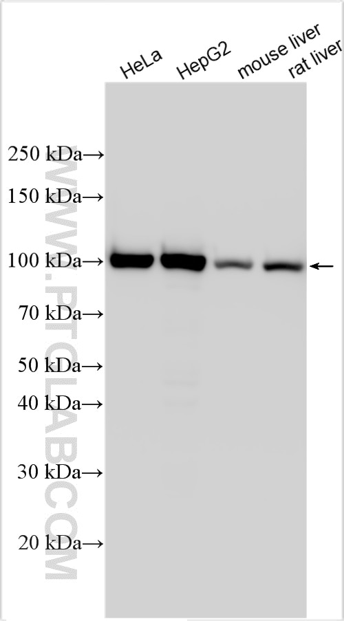 Western Blot (WB) analysis of various lysates using MARS Polyclonal antibody (14829-1-AP)