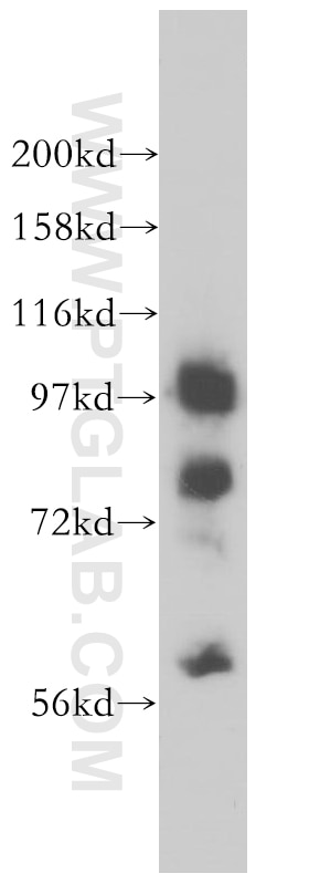 MARS Polyclonal antibody