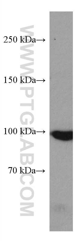 Western Blot (WB) analysis of A431 cells using MARS Monoclonal antibody (67739-1-Ig)