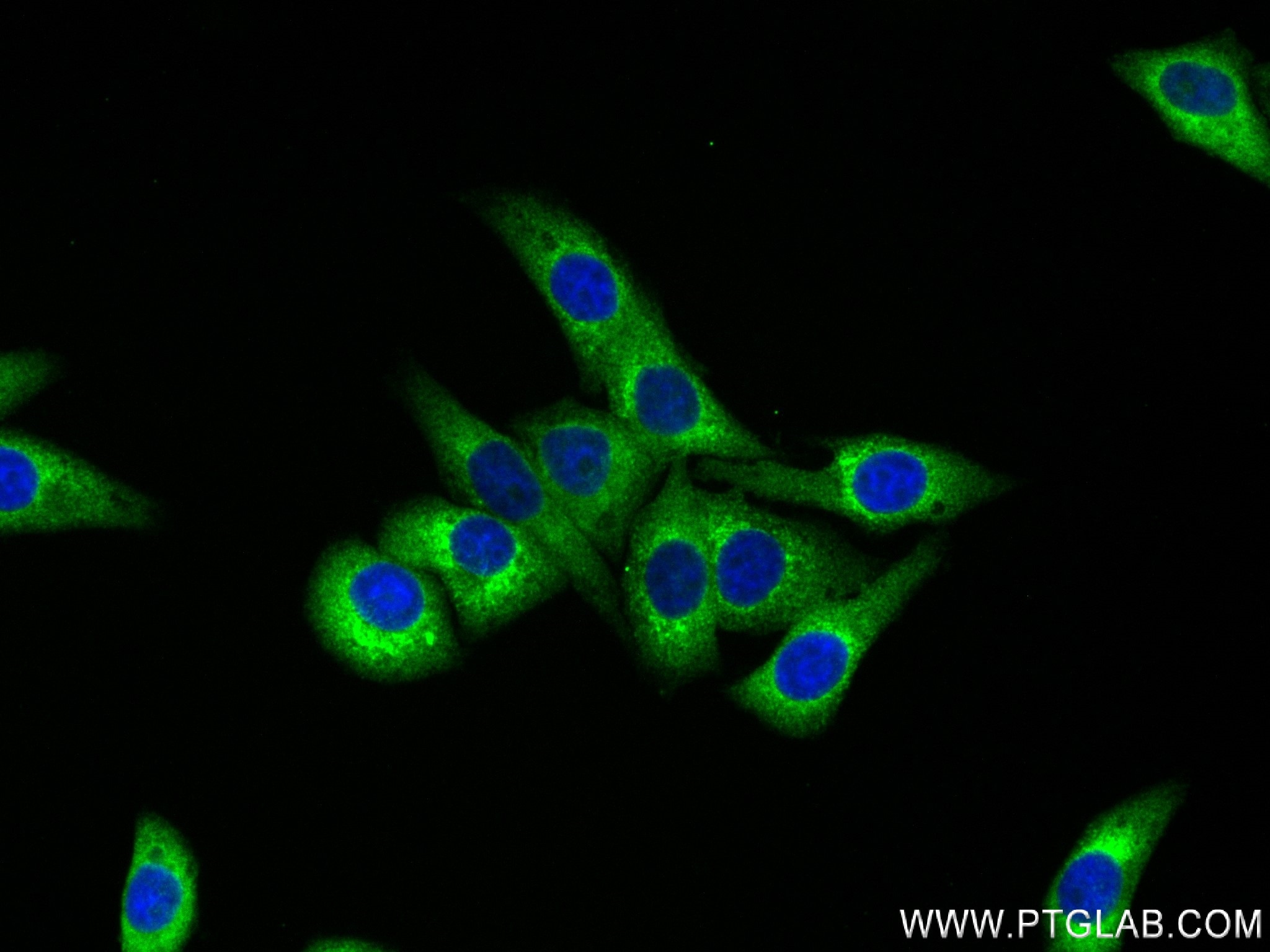 Immunofluorescence (IF) / fluorescent staining of HepG2 cells using MARS Recombinant antibody (83690-5-RR)