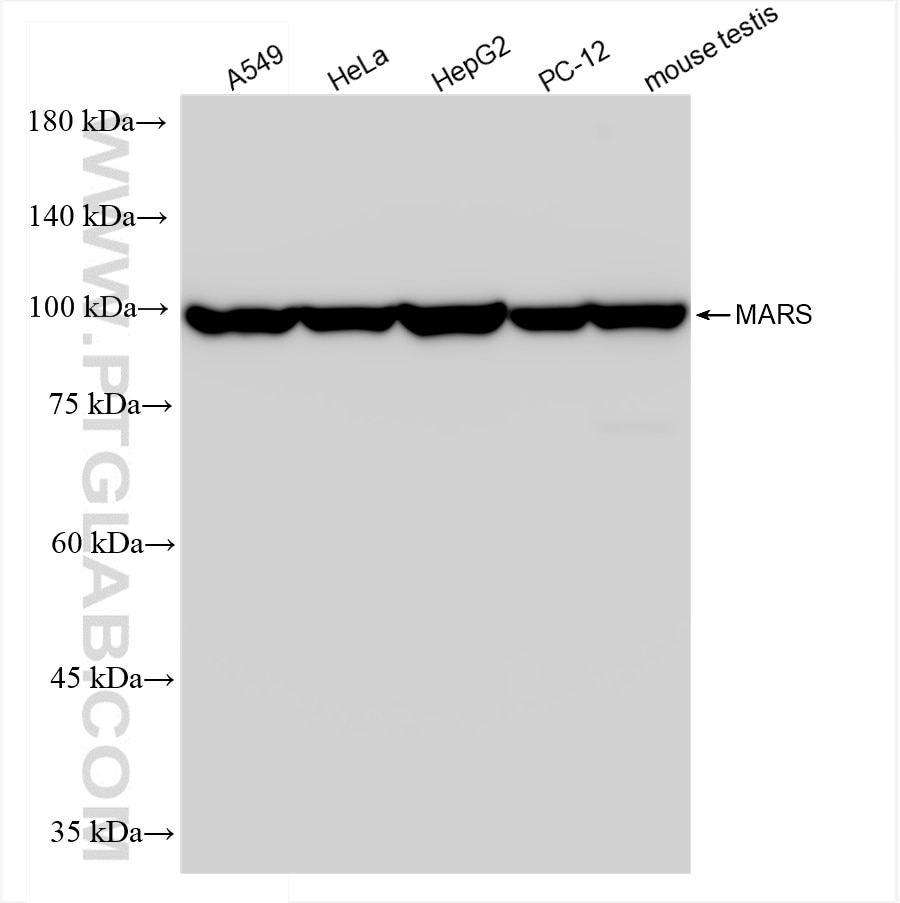 Western Blot (WB) analysis of various lysates using MARS Recombinant antibody (83690-5-RR)