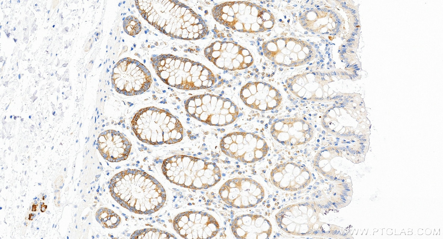 IHC staining of human colon using RMX00063 Immunohistochemistry (IHC) staining of human colon tissue using Multi-rAb® MARS Multi-Recombinant antibody (RMX00063)