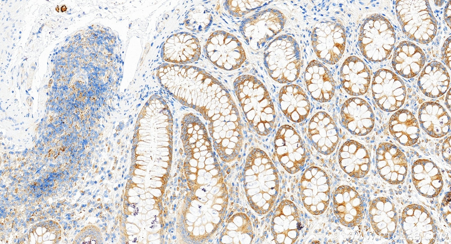 IHC staining of human colon using RMX00063 Immunohistochemistry (IHC) staining of human colon tissue using Multi-rAb® MARS Multi-Recombinant antibody (RMX00063)