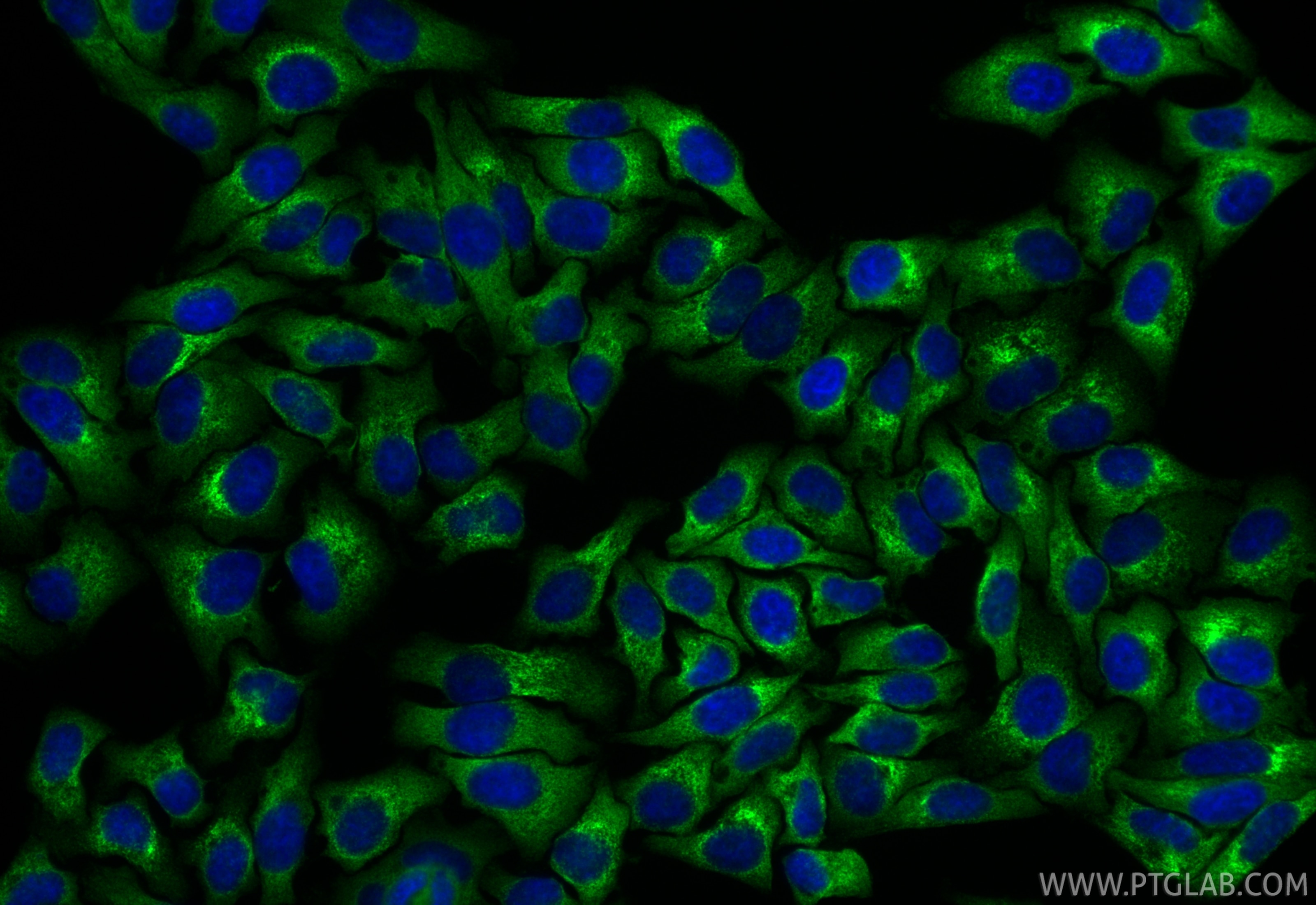 IF Staining of HepG2 using RMX00063 Immunofluorescence (IF) / fluorescent staining of HepG2 cells using Multi-rAb® MARS Multi-Recombinant antibody (RMX00063)