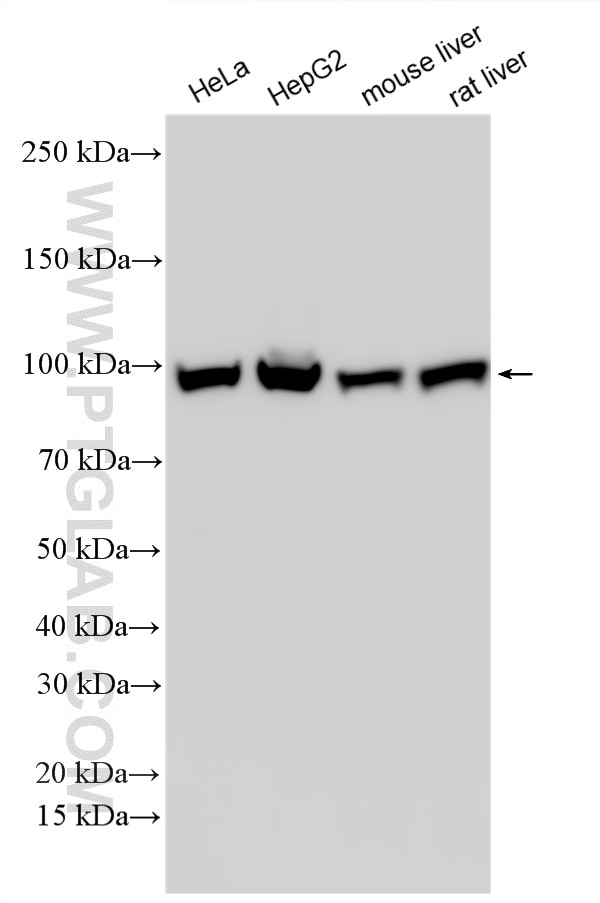 WB analysis using RMX00063 Western Blot (WB) analysis of various lysates using Multi-rAb® MARS Multi-Recombinant antibody (RMX00063)