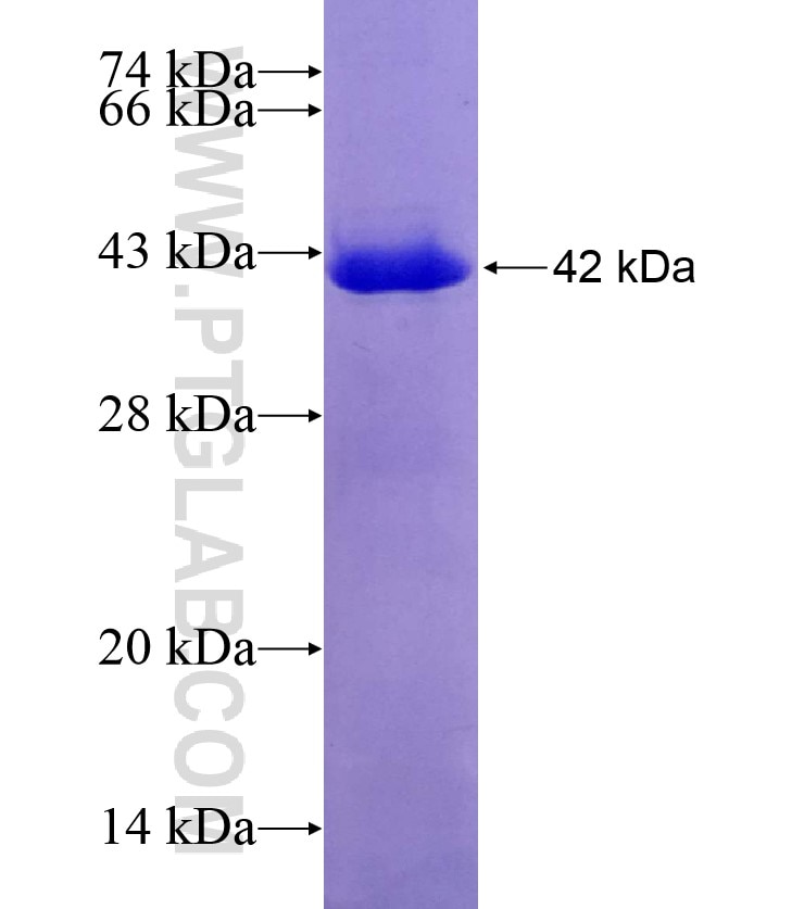 MARS fusion protein Ag6961 SDS-PAGE