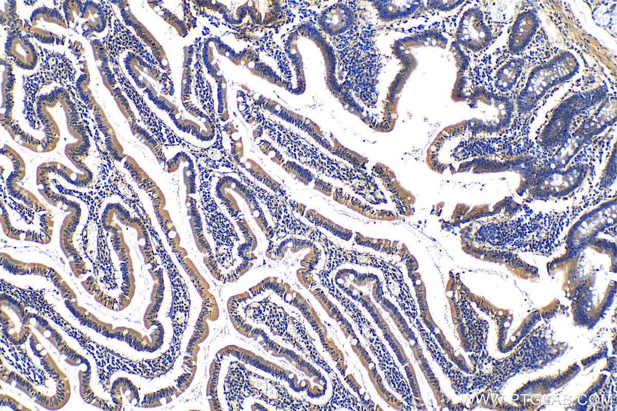 Immunohistochemistry (IHC) staining of human stomach tissue using MARVELD2 Polyclonal antibody (13515-1-AP)