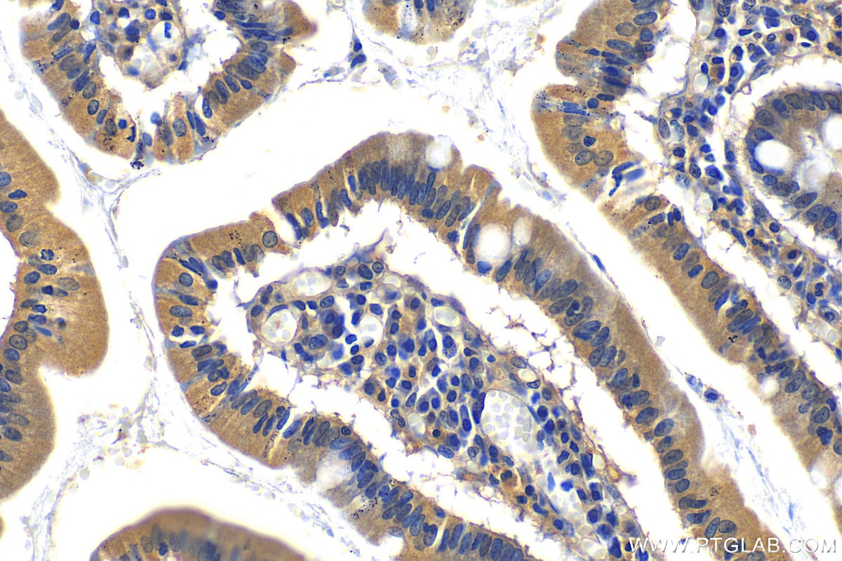 Immunohistochemistry (IHC) staining of human stomach tissue using MARVELD2 Polyclonal antibody (13515-1-AP)