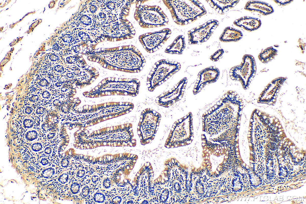 Immunohistochemistry (IHC) staining of human small intestine tissue using MARVELD2 Polyclonal antibody (13515-1-AP)