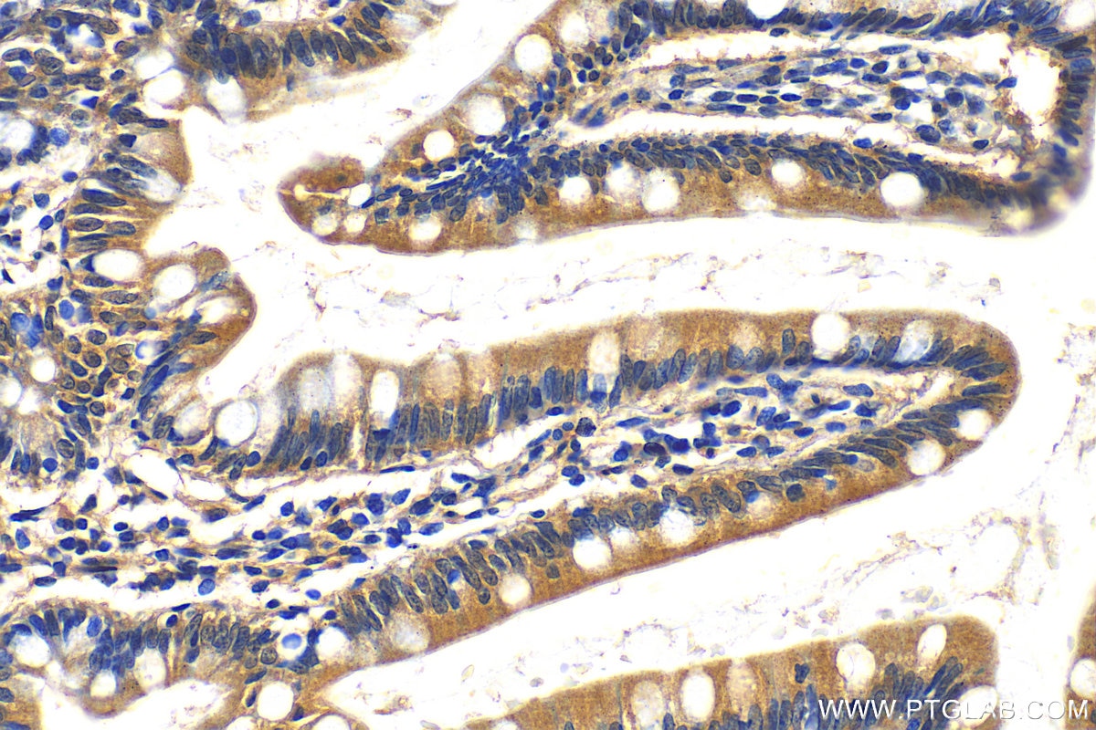 Immunohistochemistry (IHC) staining of human small intestine tissue using MARVELD2 Polyclonal antibody (13515-1-AP)