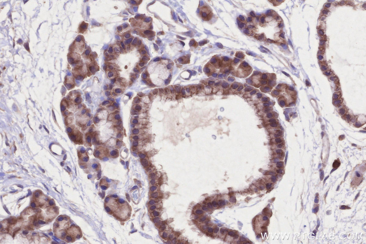 Immunohistochemistry (IHC) staining of rat thyroid gland tissue using MARVELD2 Polyclonal antibody (13515-1-AP)