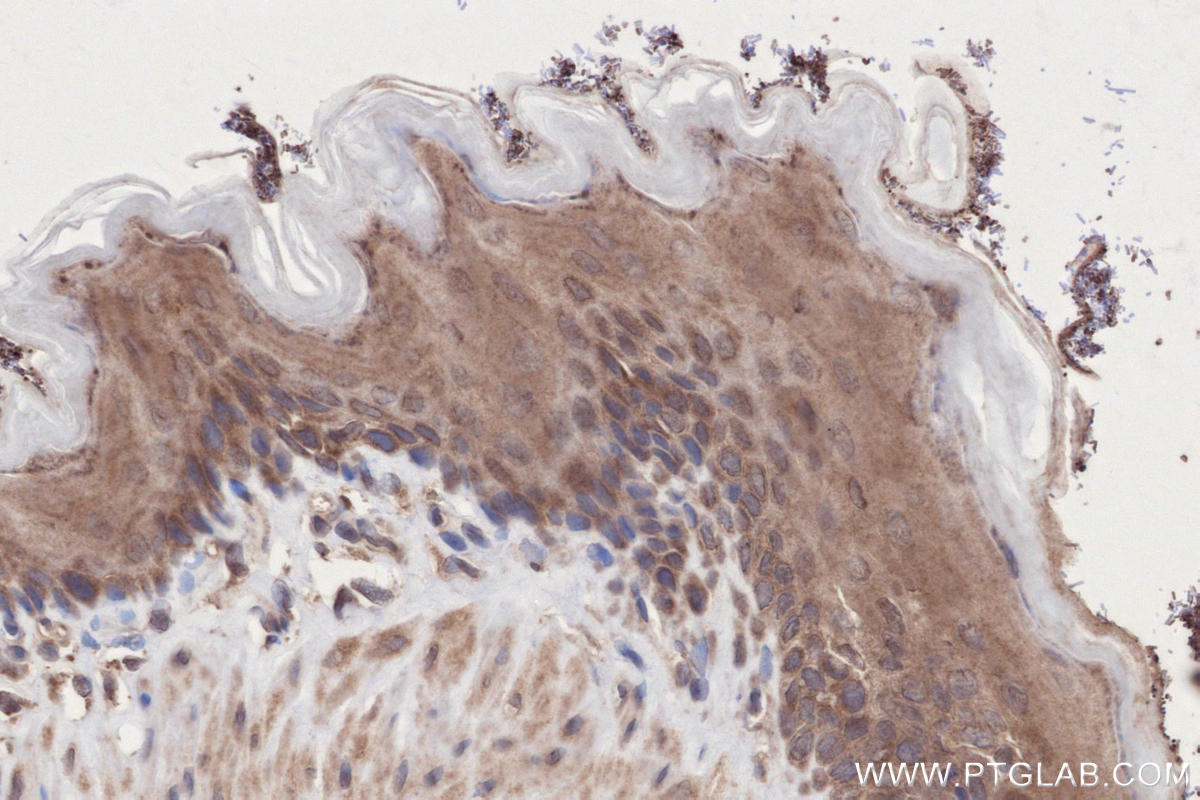 Immunohistochemistry (IHC) staining of rat stomach tissue using MARVELD2 Polyclonal antibody (13515-1-AP)
