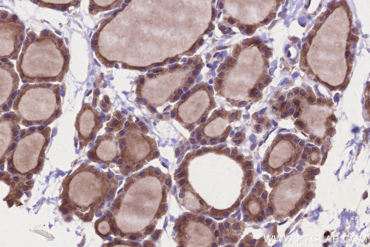 Immunohistochemistry (IHC) staining of rat thyroid gland tissue using MARVELD2 Polyclonal antibody (13515-1-AP)