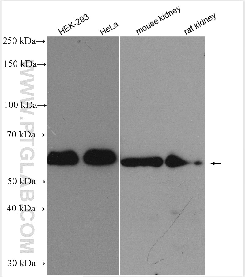 Western Blot (WB) analysis of various lysates using MARVELD2 Polyclonal antibody (13515-1-AP)