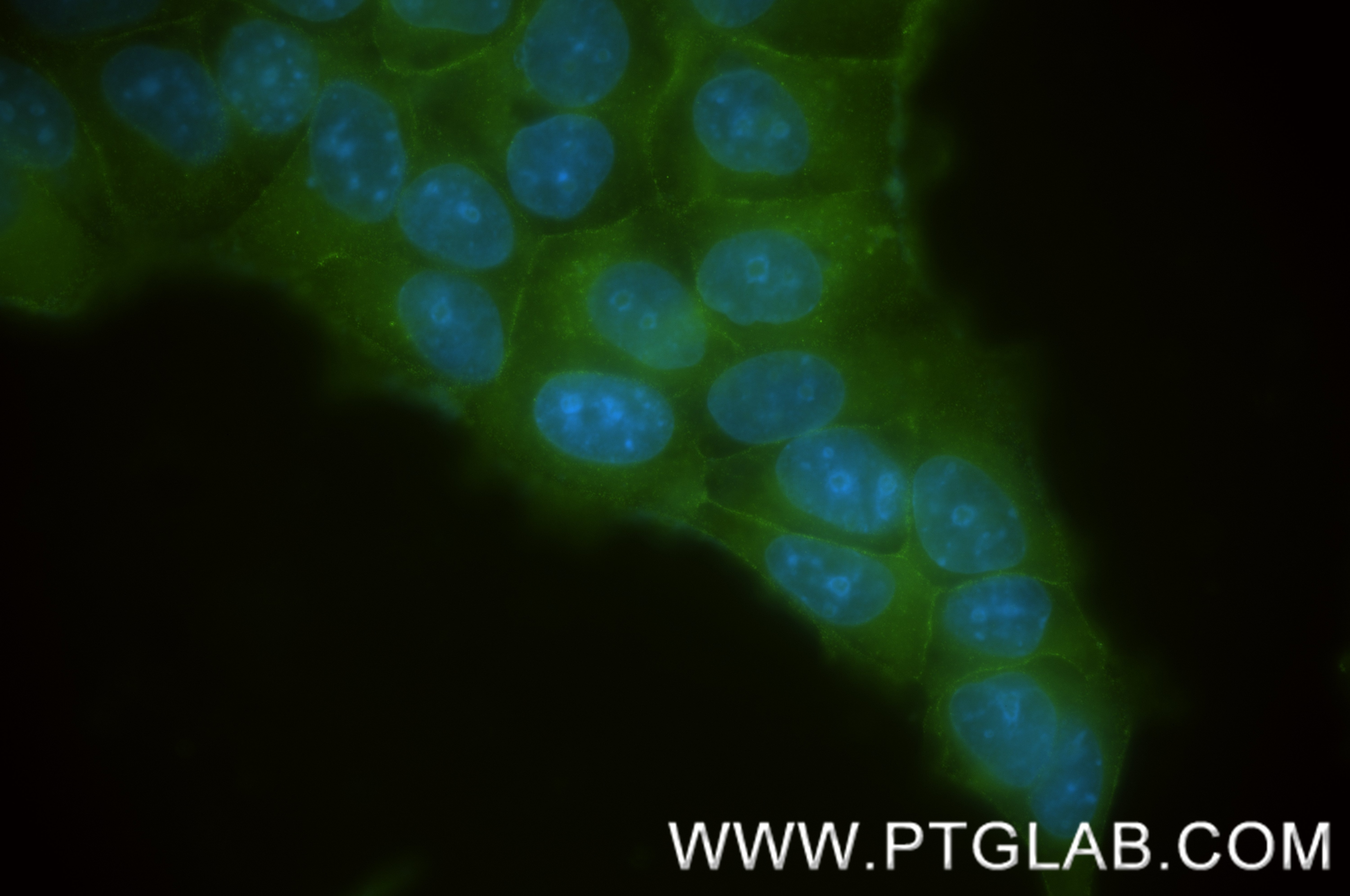Immunofluorescence (IF) / fluorescent staining of MCF-7 cells using MARVELD2 Recombinant antibody (86188-1-RR)