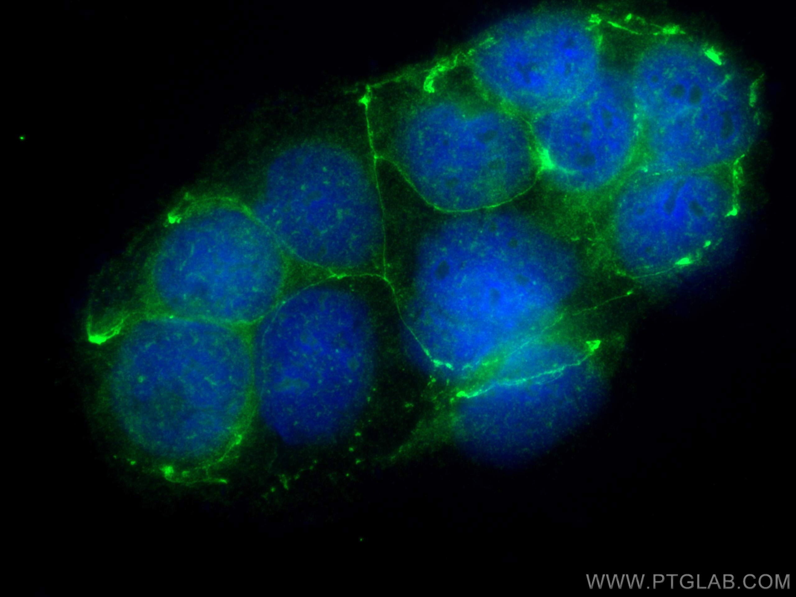 Immunofluorescence (IF) / fluorescent staining of Caco-2 cells using MARVELD3 Polyclonal antibody (25667-1-AP)