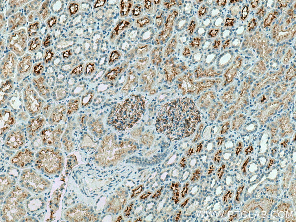 Immunohistochemistry (IHC) staining of human kidney tissue using MARVELD3 Polyclonal antibody (25667-1-AP)