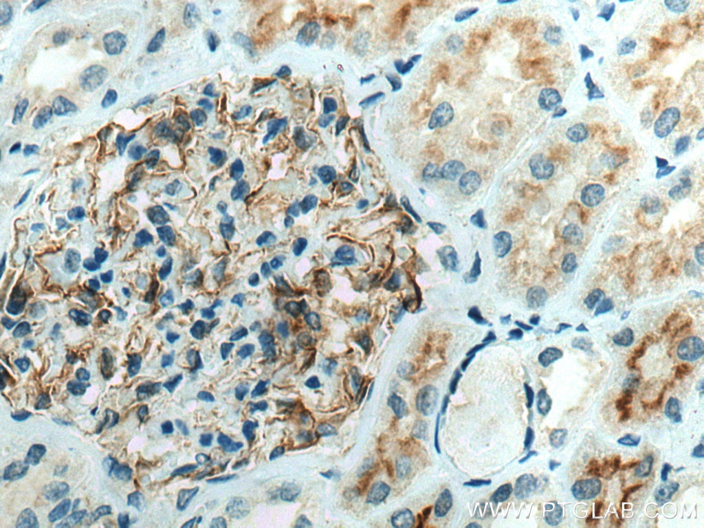 Immunohistochemistry (IHC) staining of human kidney tissue using MARVELD3 Polyclonal antibody (25667-1-AP)