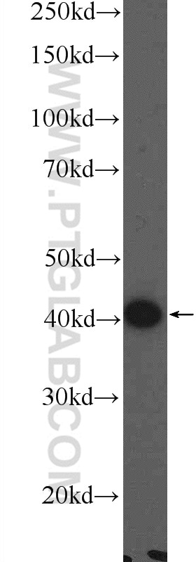 Western Blot (WB) analysis of COLO 320 cells using MARVELD3 Polyclonal antibody (25667-1-AP)