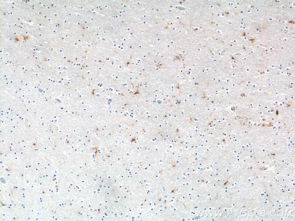 Immunohistochemistry (IHC) staining of human brain tissue using MAS1L Polyclonal antibody (21029-1-AP)